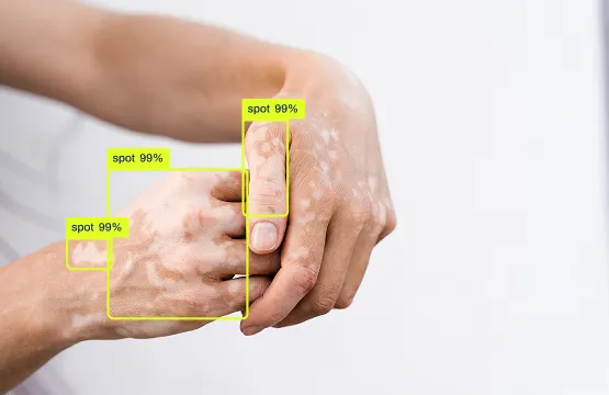 Object detection in healthcare