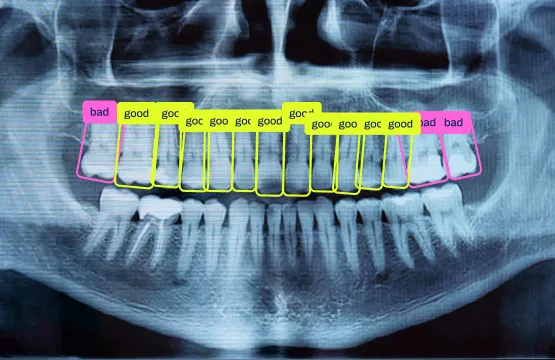 OBB detection in x-rays